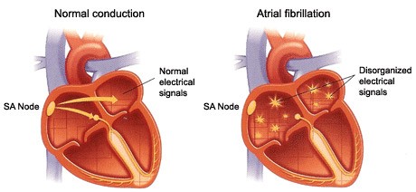 How the Heart Starts Beating